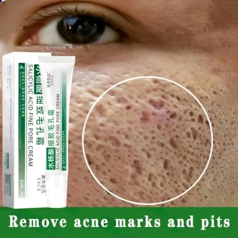 Salicylic Acid Pore Clearing C - огляд і ціна Salicylic Acid Blackhead Remover