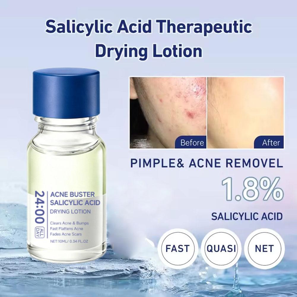 Salicylic Acid Acne Buster Rem - огляд і ціна Salicylic Acid Blackhead Remover